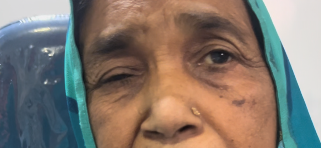 Why is my eye lid twitching and how to treat it